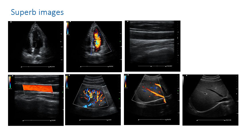 superb ultrasound images by ES211 digital portable color Doppler ultrasound machine